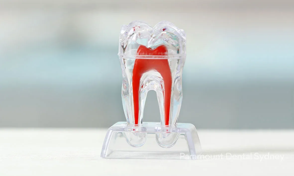 Clear tooth model showing the red pulp inside the tooth
