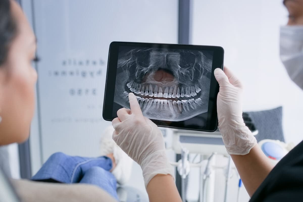 Dental team reviewing a panoramic X-ray on a tablet